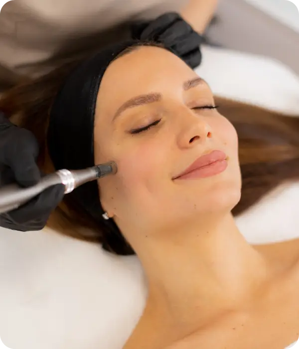 Woman getting microneedling on her face