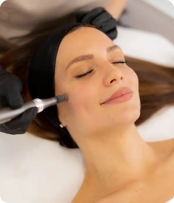 Woman getting microneedling on her face