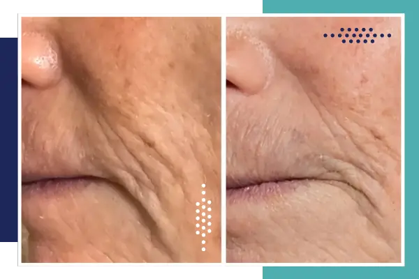 before and after image