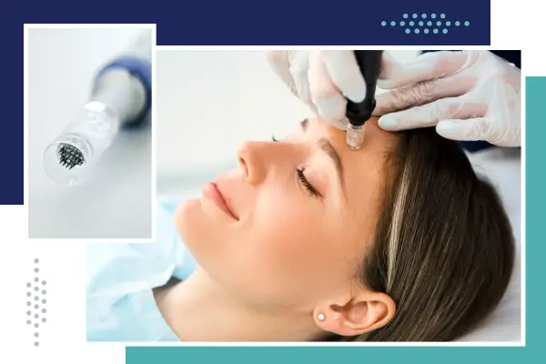 image of micro needling